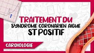 Prise en Charge amp Traitement du Syndrome Coronarien Aigu avec Segment ST Positif [upl. by Nimar73]