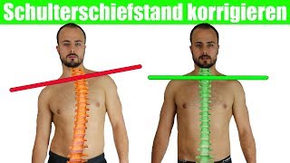 Schulterschiefstand beheben  Krumme Wirbelsäule  Brustkorb aufrichten [upl. by Corissa]