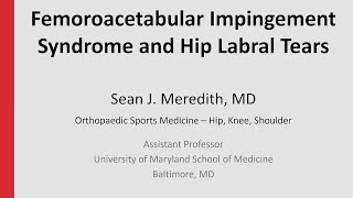 Femoroacetabular Impingement Syndrome and Hip Labral Tears [upl. by Eulau801]