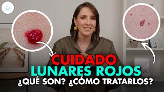 7 remedios naturales para curar rasguños en la piel [upl. by Yelyr]