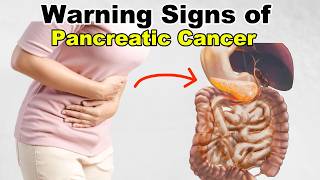 10 Warning Signs of Pancreatic Cancer  How to Reduce the Risk [upl. by Azeel204]