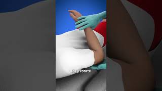 Should Dislocation Treatment  3 D Animation anatomy fracture shortsvideo viralvideo [upl. by Hosea712]