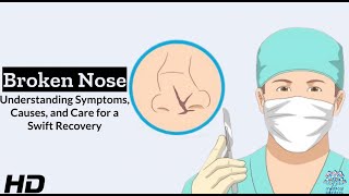 Broken Nose Understanding Symptoms Causes and Cures 1080p 231026 [upl. by Aened]