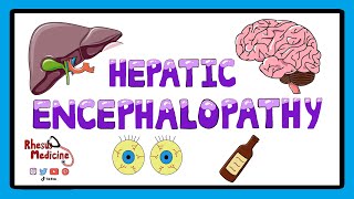 Hepatic Encephalopathy  Pathophysiology Stages and West Haven Criteria [upl. by Jecho]