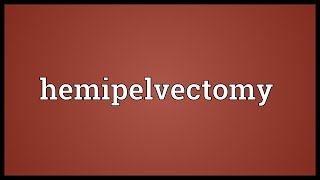 Hemipelvectomy Meaning [upl. by Yorgos]