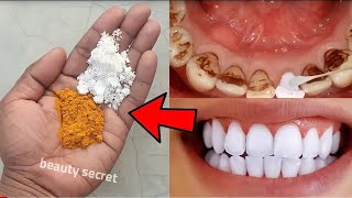 Teeth whitening and scaling at home in 1 minute you will get pearl white teeth [upl. by Ardnekat]