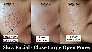 4 Step Glow Facial  Close Large OPEN PORES Remove DARK SPOTS amp get Glowing Skin  Aloevera icecube [upl. by Bixler]