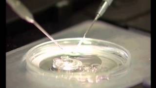 ICSI  Intra Cytoplasmic Sperm Injection sh [upl. by Nwadrebma335]