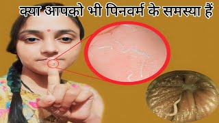 सिर्फ 1 रात मे Pinworms होगा खत्म  How to get rid of Pinworms  Threadworms treatment at home [upl. by Dowling]