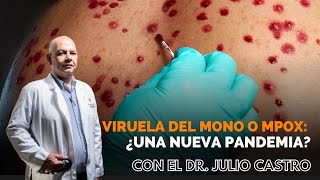 ¿La viruela del mono puede convertirse en una pandemia como el Covid19  Parte Médico [upl. by Cheung]