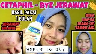 REVIEW CETAPHIL GENTLE SKIN CLEANSER  CARA MENGHILANGKAN JERAWAT amp BRUNTUSAN by Khairunnisa Adlina [upl. by Amble]