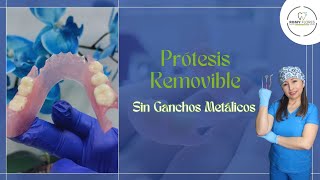 Prótesis removible flexible La mejor alternativa sin ganchos metálicos [upl. by Saltsman]