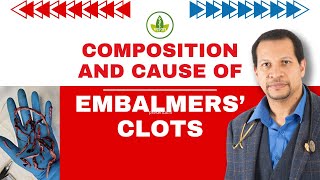 Embalmers Clots EXPOSED Whats Really Causing Them [upl. by Auqinet802]