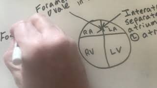 Interatrial septum ampInterventricular septum [upl. by Ary]