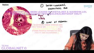 CNS  NON NEOPLASTIC LESIONS By Dr Illa jain khandelwal Pathology by Marrow Video Lecture [upl. by Ynaffets]