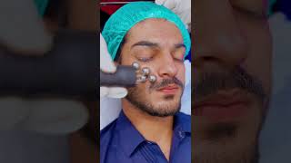 HydraFacial by MR Aesthetics trending youtubeshorts shorts short beauty aestheticsclinic [upl. by Pazice]