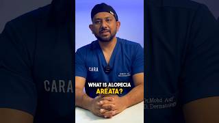 Understanding Alopecia Areata with Dr Asif  Alopecia Awareness Month [upl. by Kelam860]