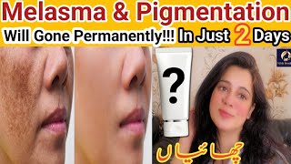 Permanently remove pigmentation on face  Melasma hyperpigmentation treatment  Skin pigmentation [upl. by Prasad232]