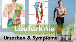 Das hilft bei Läuferknie  Symptome amp Ursachen erklärt [upl. by Ellett670]