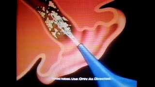 Murine Ear Wax Removal System commercial Family Channel March 10 1992 [upl. by Uriiah]