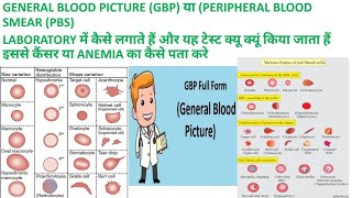 CBC SE GBP या PBS GENERAL BLOOD PICTURE or PERIPHERAL BLOOD SMEAR KI REPORT KAISE BANAYE [upl. by Sennahoj]