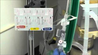 How to Setup an Arterial Line Transducer [upl. by Middlesworth]