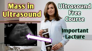 Can masses be seen on ultrasound  Does hypoechoic mass mean cancer [upl. by Mirilla57]