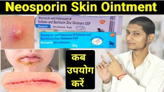 Neomycin and polymyxin b sulfates and bacitracin zinc ointment usp in hindi  neosporin ointment [upl. by Ardnosak]