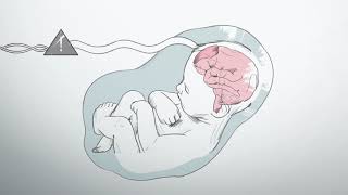 What is hypoxic ischemic encephalopathy [upl. by Aiyekal]