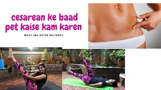 Cesarean ke baad pet kaise kam karen How to Reduce Belly Fat Post C Section  Hindi  Workout Flow [upl. by Vally332]