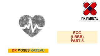 ECG LBBB Part 5 [upl. by Spain]