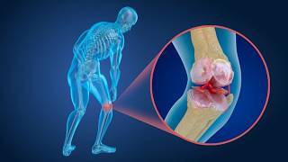 DESCUBRA COMO FUNCIONA AS ARTICULAÇÕES DO CORPO  CARTILAGEM CAPSULA LIGAMENTOS [upl. by Seroled]