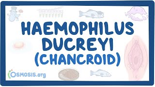 Haemophilus ducreyi Chancroid  an Osmosis Preview [upl. by Ydur758]