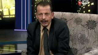 مقابله الدكتور إسماعيل الكبسي استشاري جراحة الأعصاب dr Ismail Alkebsi Yemen today interview [upl. by Alrzc33]