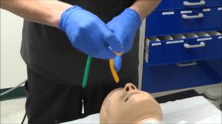 Nasal Intubation [upl. by Willman]