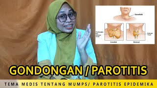 GONDONGAN  PAROTITIS EPIDEMIKA MUMPS [upl. by Ilyak]