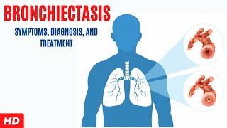 Bronchiectasis Symptoms Diagnosis and Treatment [upl. by Ervine545]