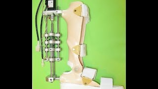 Active Ankle Foot Orthosis for Stroke Patients with Toe Drag and Foot Drop [upl. by Lecroy]