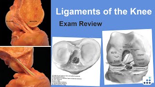 Ligaments of the Knee Exam Review  Raymond Kim MD [upl. by Roy]