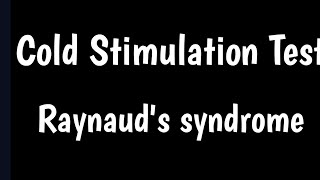 Cold Stimulation Test  Raynauds Testing  Raynauds Disease [upl. by Oiled]