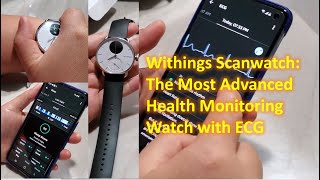 Withings Scanwatch Full Review After 2 Weeks [upl. by Ahsinit112]