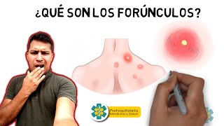 por que salen los nacidos 𝗤𝘂𝗲́ 𝘀𝗼𝗻 𝗹𝗼𝘀 𝗙𝗢𝗥𝗨́𝗡𝗖𝗨𝗟𝗢𝗦 😲 Nacidos Forunculos Abscesos [upl. by Liagaba]