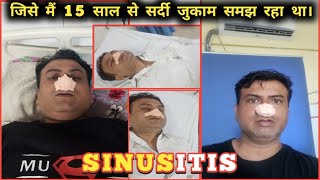 Sinusitis  Sinusitis Kya Hota Hai  Sinus Problem [upl. by Bhayani]