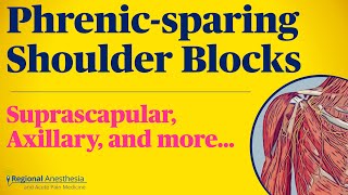 Phrenicsparing Shoulder Blocks Suprascapular and Axillary Nerve Blocks [upl. by Lilak]