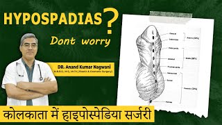 Best HYPOSPADIAS Surgery in Kolkata  Best Age for Hypospadias Surgery  Myths and Facts [upl. by Dnalyar]