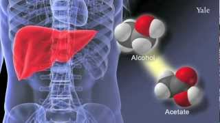 Increased brain uptake and oxidation of acetate in heavy drinkers [upl. by Nolita]