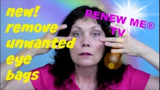 Remove Eye Bags  Under Eye Fluid  Festoons  Malar Bags Using Easy Exercise for Face  FACEROBICS® [upl. by Nahshu]