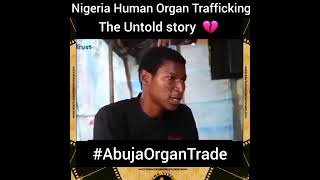 The unlawful trafficking of human organs for transplantation humanity science hospital fyp [upl. by Demetrius569]