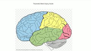 Acute Traumatic Brain Injury  Adventures in Neuropathology [upl. by Notfilc136]