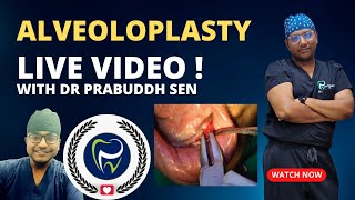 Dr Rudra Mohan  ALVEOLOPLASTY PROCEDURE LIVE  Preprosthetic Surgery  Smoothening Rough Jaw Bone [upl. by Raleigh]